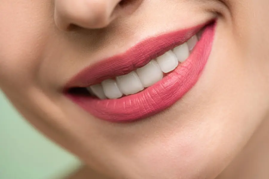 5 cose da sapere sull’estetica dentale